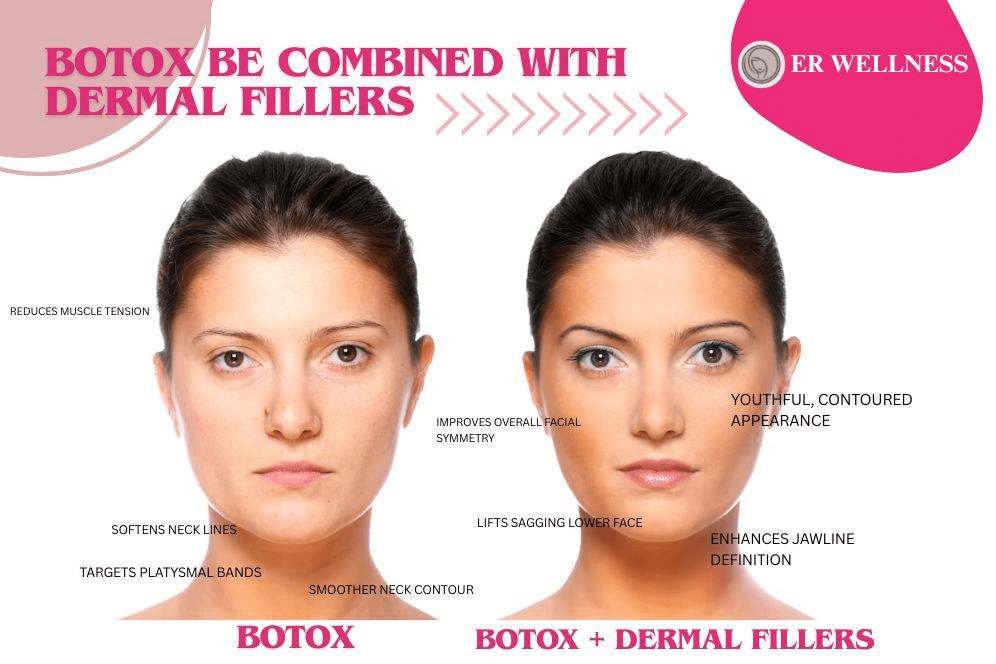 An image of two women, one before and one after a combined Botox and dermal filler treatment, showcasing the enhanced results.