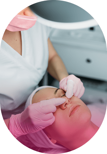 Dermaplaning in geneva, IL Dermaplaning Treatment