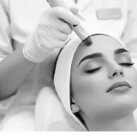 Epicutis for Redness Reduction After Microneedling