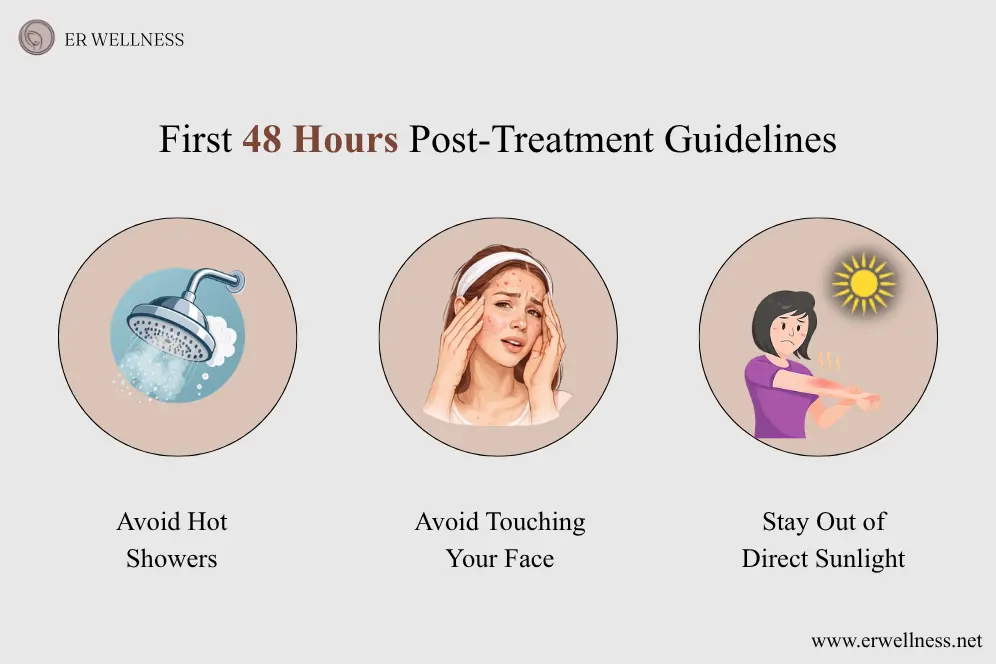 First 48 hours Post-Treatment Guidelines