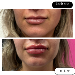 "Before and after results of a client at ER Wellness showing visible treatment improvements